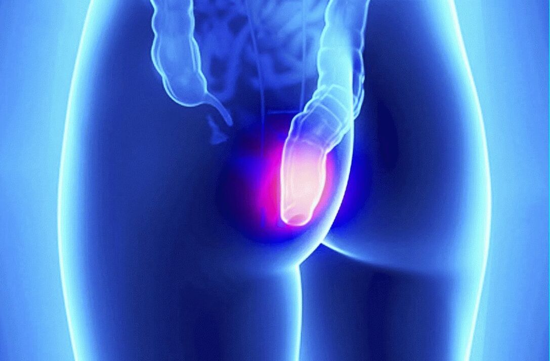 Gelarexi saab kasutada nii välispidiselt kui ka rektaalselt